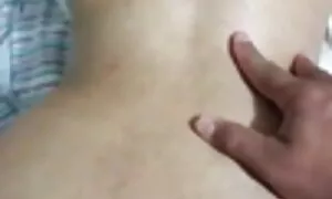 Անալի պրոլապսի դեպքո ...